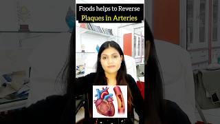 foods to help Reverse Plaques in artery  cholesterol control shorts cholesterol [upl. by Alyakim]