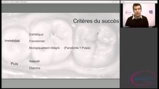 Dentisterie adhésive directe et indirecte  Matériaux traitements de surface protocoles cliniques [upl. by Ecnahs]