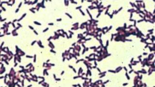 corynebacterium [upl. by Ilaire]