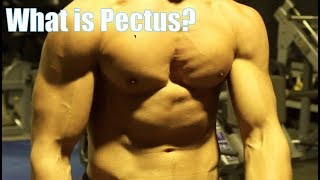 Pectus Excavatum Explained What is it What causes it How common is it [upl. by Eugene]