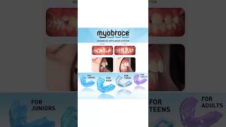 Myobrace Results  Myofunctional Appliances  Holistic Treatment shorts youtubeshorts myobrace [upl. by Billmyre]