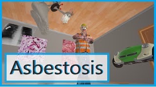 Asbestosis Mnemonic for the USMLE [upl. by Ellan658]