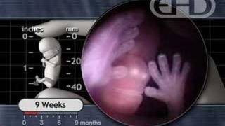 Fetal Development  The Eyelids Close [upl. by Llacam]