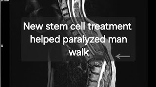 New stem cell treatment helped paralyzed man walk again [upl. by Latouche]