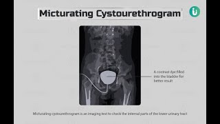 Anterograde Urethrography Xray  Micturating CystoUrethrogram Xray [upl. by Chamkis806]