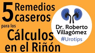 Los REMEDIOS CASEROS que funcionan MEJOR para piedras urotips [upl. by Nylidnarb]