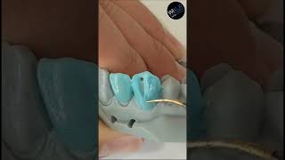 Live Wax Up  Upper Canine [upl. by Breena]