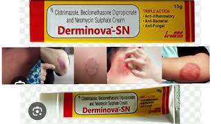 Derminova SN Cream Clotrimazole Beclomethasone Dipropionate and Neomycin Sulphate Cream [upl. by Ahsiri]