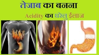 Acidity Problem  तेजाब बनना  बिना अंग्रेजी दवा के सरल उपाय  100 solution  होम Remedies [upl. by Malita357]