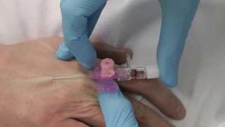 Cannulation How to gain IV access [upl. by Ezana]