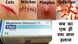 Mupirocin ointment  T bact ointment  mupirocin ointment ip uses in hindi l t bact cream [upl. by Fran]