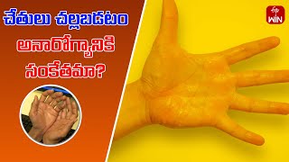 Are cold palms a sign of illness   Health Tip  Aarogyamastu  6th Nov 2024  ETV Life [upl. by Collum151]