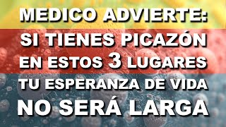 ¡CUIDADO 🔴 Si Sientes PICAZÓN en Estas Áreas Ve al MÉDICO [upl. by Onifur]