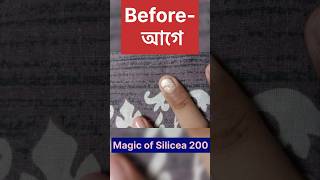 Magic of Silicea 200  ম্যাজিক অফ সিলিসিয়া 200shots youtubeshorts video shortvideo drsmondal [upl. by Wehner]