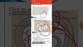 Echinococcus granulosus  lecture 4 of parasitology  part 1  فرقة أولى كلية التمريض [upl. by Anora]