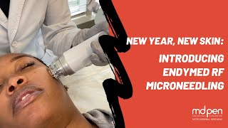 New Year New Skin Introducing Endymed RF Microneedling [upl. by Obala]