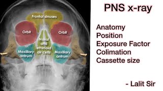 PNS xRay in hindi [upl. by Fernanda39]