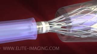 Heart Valve Catheter Loading  Medical amp Scientific Video Production [upl. by Ettenuahs161]