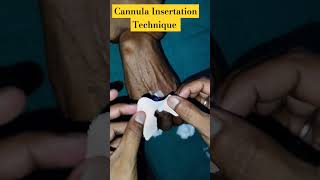 135 IV Cannula Insertation Technique  IV Cannula Kaise Lagate Hai short viral video trend reel [upl. by Filberto319]