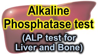 Alkaline phosphatase test  ALP test for liver and bones  ALP test [upl. by Rafter]