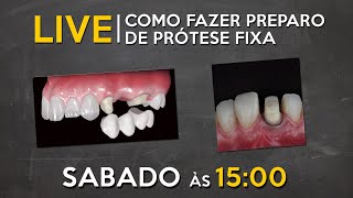 LIVE 060  Como fazer preparo de prótese fixa [upl. by Midis143]