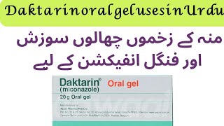 Daktarin oral gel uses  how to use daktarin oral gel  miconazole [upl. by Aropizt844]