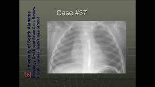 ultrasound radiologysonology [upl. by Eanaj]