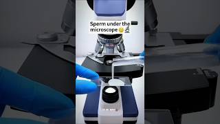 Sperm under the microscope 😦 🔬viralvideo microscope shortfeed animals shorts reels [upl. by Yentruok359]