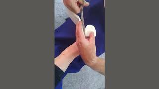 Instruction for use of 7mm Felt Chiropody Padding [upl. by Remmer601]