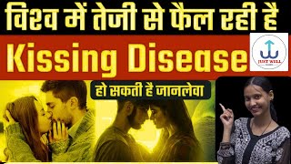 What is kissing disease  kissing Disease Virus  Symptoms of Kissing Disease Just well classes [upl. by Sharos]