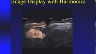 SONOWORLD Enhanced Ultrasound in the Abdomen Liver and Kidneys Edward G Grant MD [upl. by Ninos]