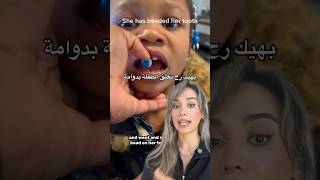 خلع سن لبني 🤓🦷 اسنان اكسبلور sanathedentist [upl. by Ahsena]