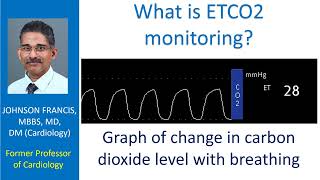 What is ETCO2 monitoring [upl. by Fredek586]