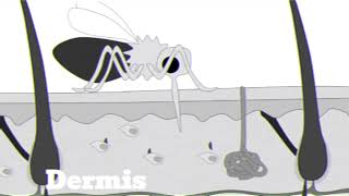 Leishmaniasis in dogs [upl. by Clayborn]