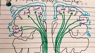 Periventricular leukomalacia  for exam going pgs [upl. by Akeirahs]