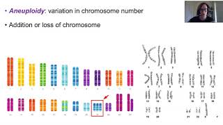 Chromosome abnormalities [upl. by Drannel595]