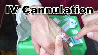 How to Insert IV Cannula  IV Cannulation Technique  Branula  Intravenous Catheter [upl. by Ratib]