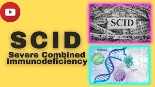 SCID Severe Combined Immunodeficiency  Genesis Academy delhi [upl. by Azirb]