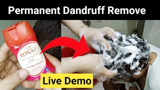 Anti Dandruff Medicated Shampoo Honest Review  Works Or Not  Conaz Lotion for Hair [upl. by Nawk]