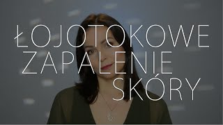 Łojotokowe zapalenie skóry [upl. by Waki]