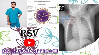 Respiratory Syncytial Virus  Bronchiolitis [upl. by Tacita]