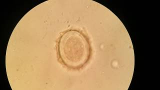 Ascaris lumbricoides fertilized corticated egg [upl. by Baskett]