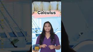 Dental Calculus  பற் காறை [upl. by Aniloj]