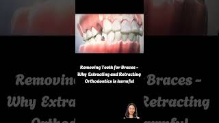 Removing Teeth for Braces braces orthodontist dentist bracesoff [upl. by Aisayt109]