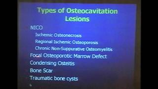 Diagnosis and Treatment of Cavitational Osteonecrosis [upl. by Yllrebmik]