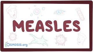 Measles  causes symptoms diagnosis treatment pathology [upl. by Caresa]