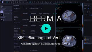 Hermia SIRT For Selective Internal Radiation Therapy [upl. by Suoilenroc525]