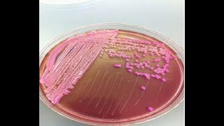 Klebsiella 2 S2650 Microbiology MCQs [upl. by Yesiad]