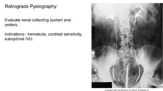 Radiology of the Urogenital system [upl. by Persons]