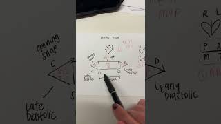 MURMUR MAN FOR CARDIAC MURMURS MNEMONIC [upl. by Kosey]